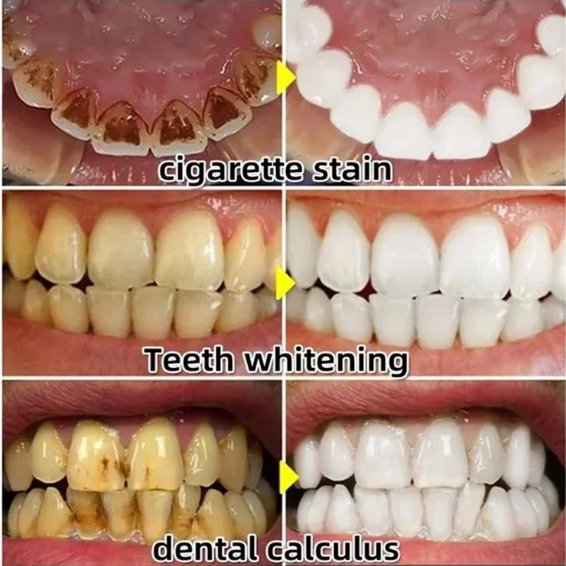 Quickly Repair Gum Serum Relie - Teeth Whitening With Baking Soda recension och pris