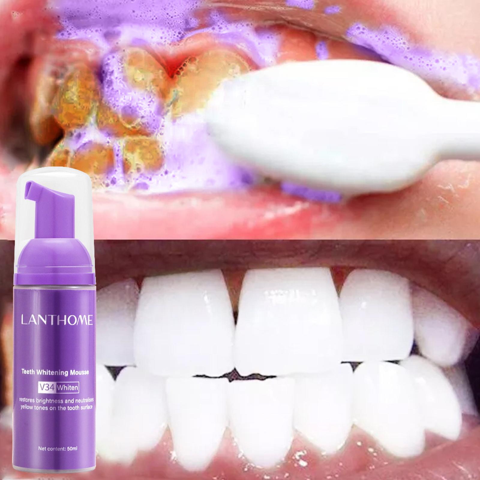 V34 Mousse Teeth Cleaning Toot - Teeth Whitening Mousse recension och pris