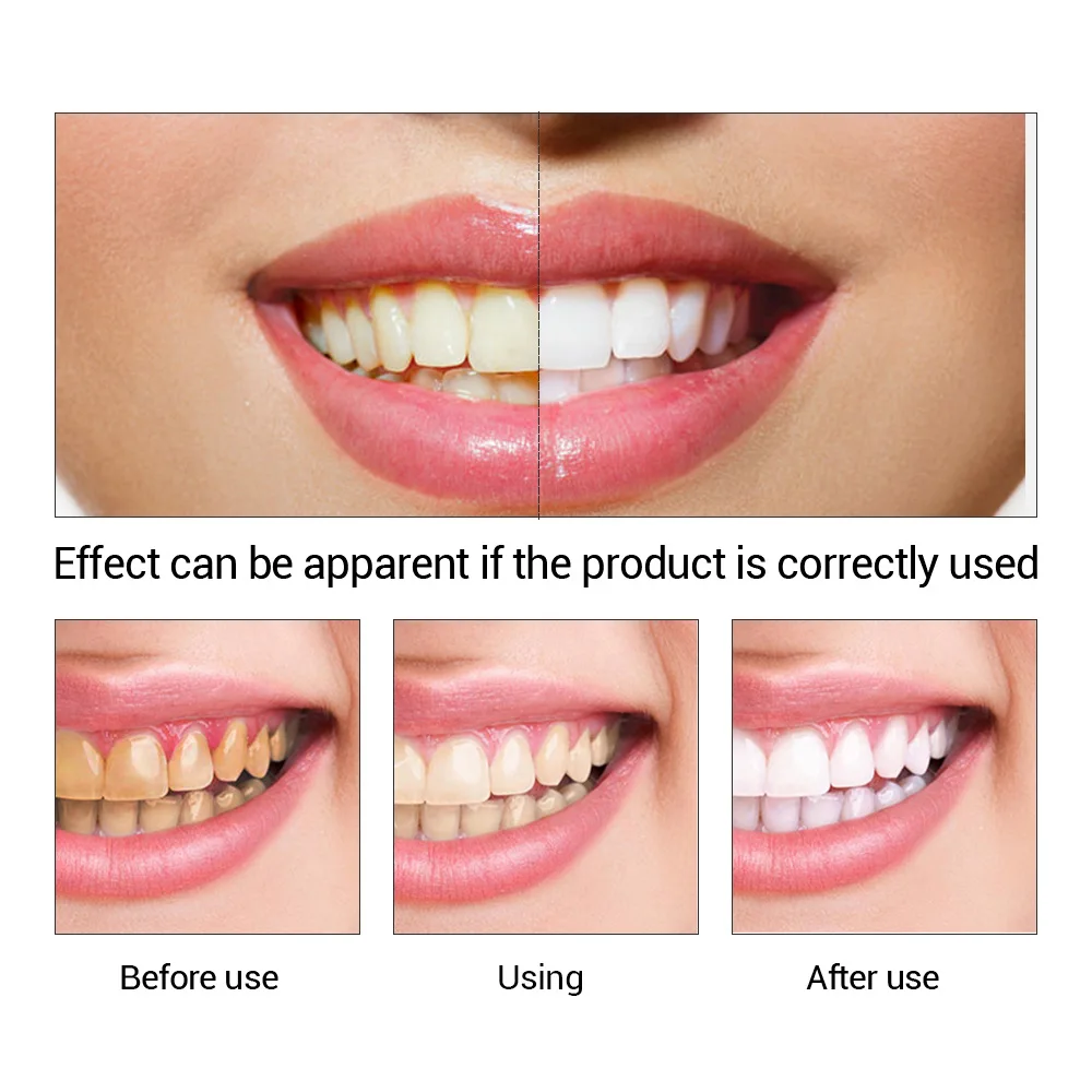FTEENPLY Teeth Whitening Essen - Teeth Whitening Essence recension och pris