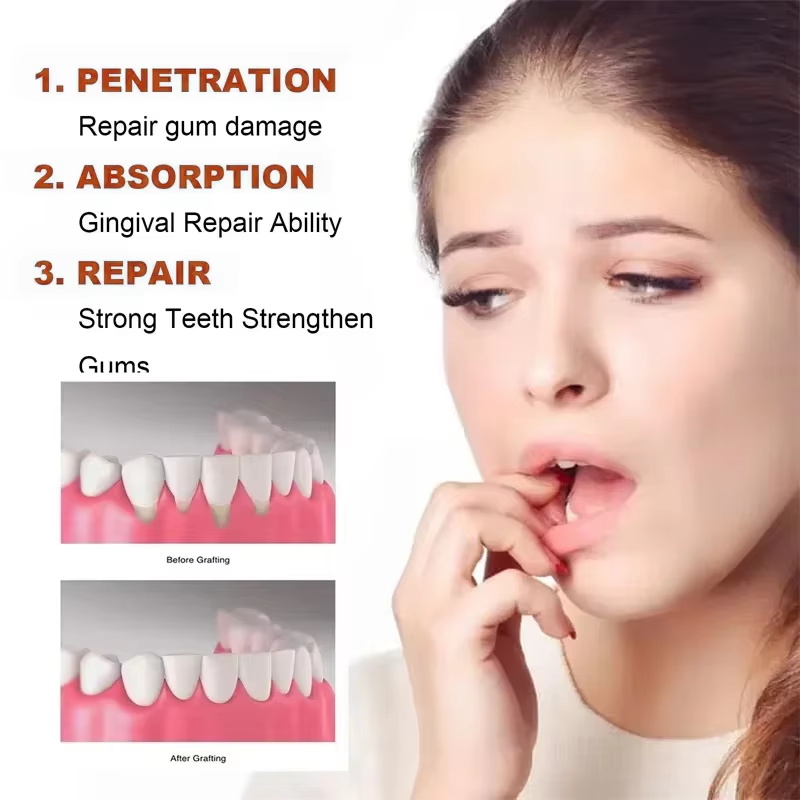 Rapid Repair Gums Serum Effect - Teeth Whitening Mousse recension och pris