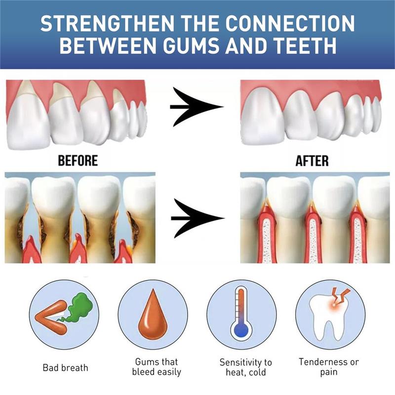 Rapid Repair Gums Serum Effect - Teeth Whitening Mousse recension och pris