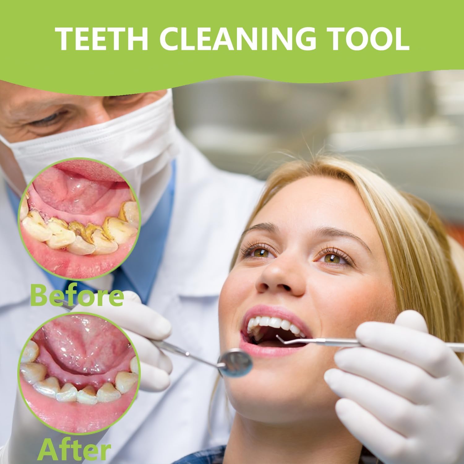 Professional Teeth Cleaning Or - Teeth Whitening Mouthwash recension och pris