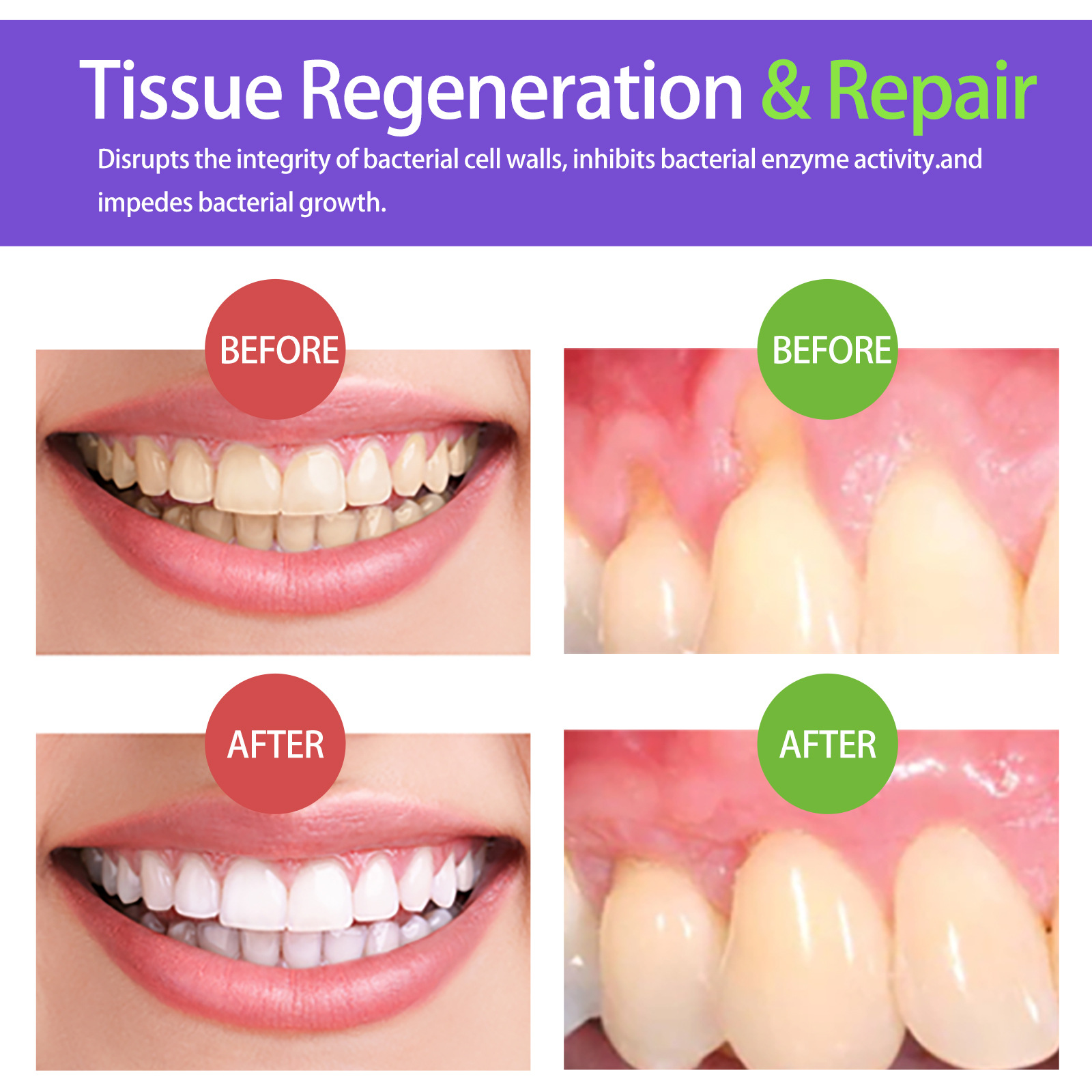 60ml Teeth Whitening Mousse V3 - Teeth Whitening Mousse recension och pris